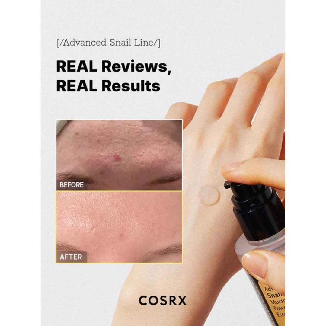 COSRX - Advanced Snail 96 Mucin Power Essence - 100 ml - Cosmetic Holic